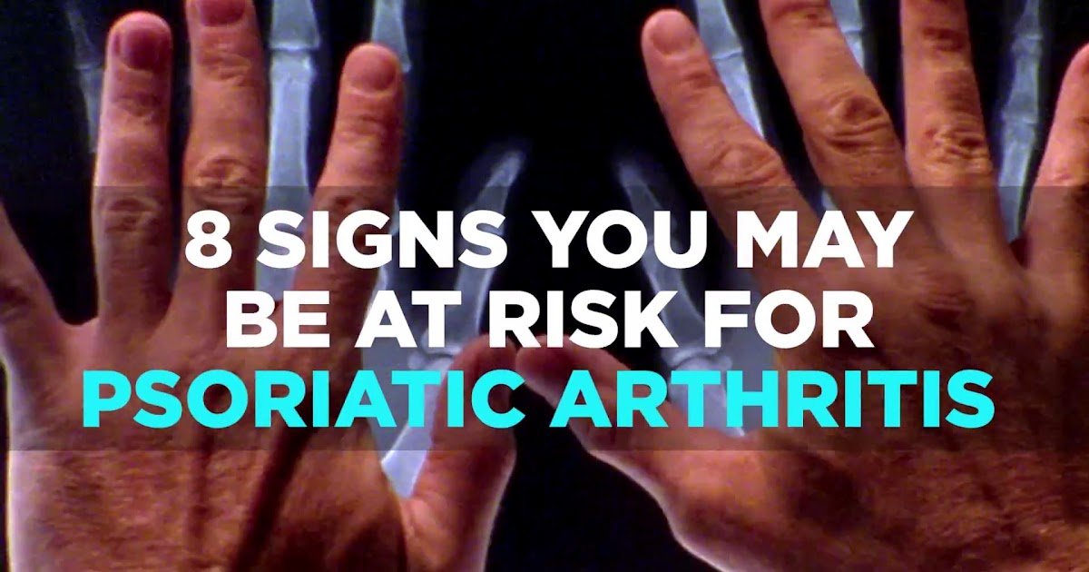 Can You Have Psoriatic Arthritis Without Swelling