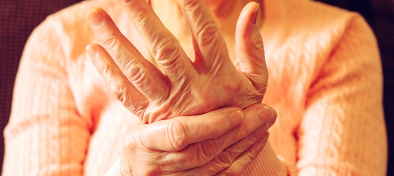Can You Prevent Rheumatoid Arthritis?