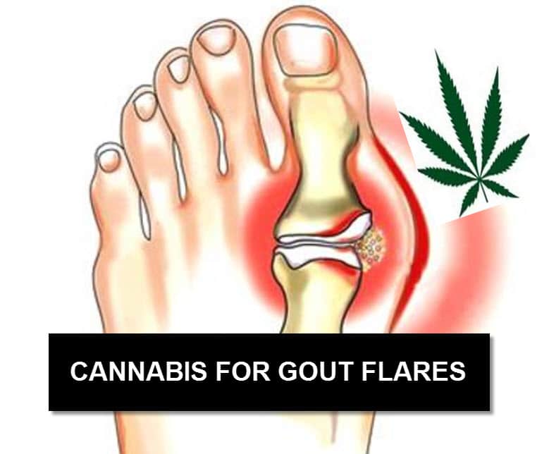 Cannabis For Gout