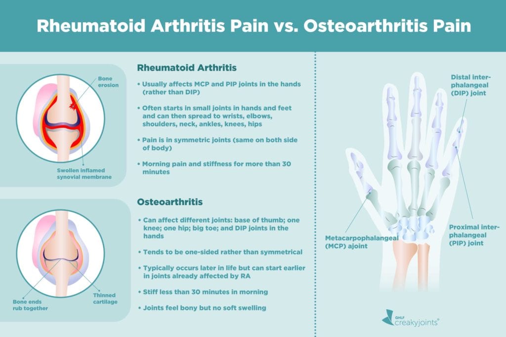Causes of Rheumatoid Arthritis Pain Aside from Inflammation