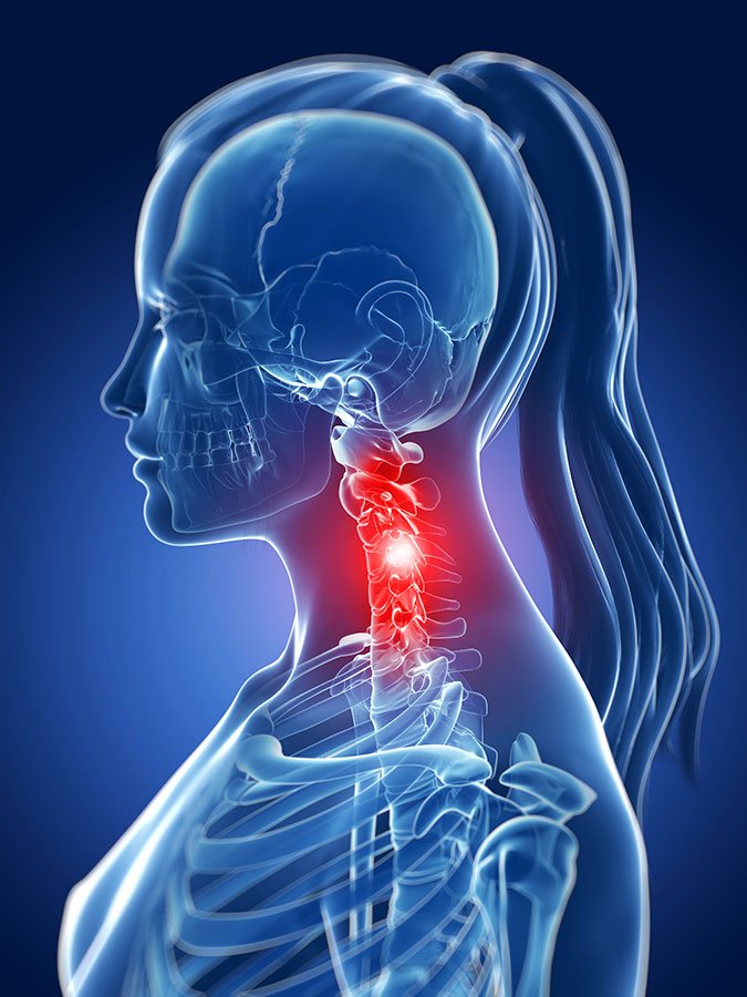 Cervical spondylosis means Neck Joint Degeneration: Stiff neck joints