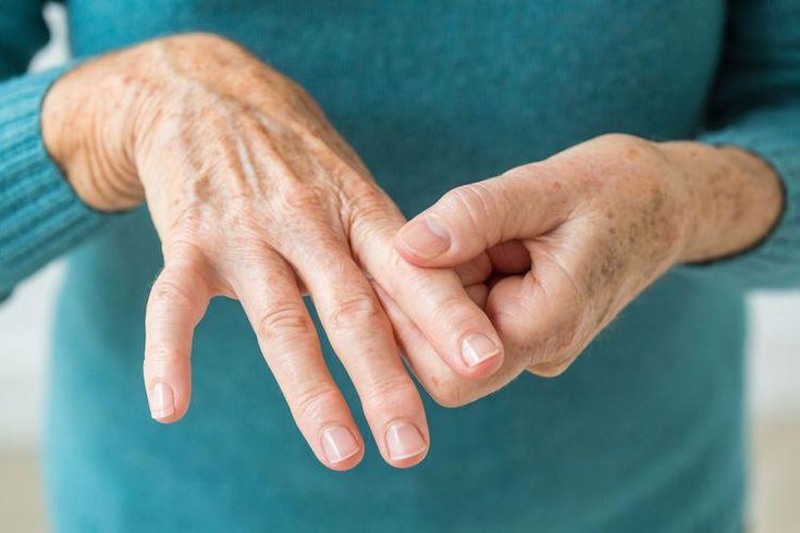 Could You Have Psoriatic Arthritis?