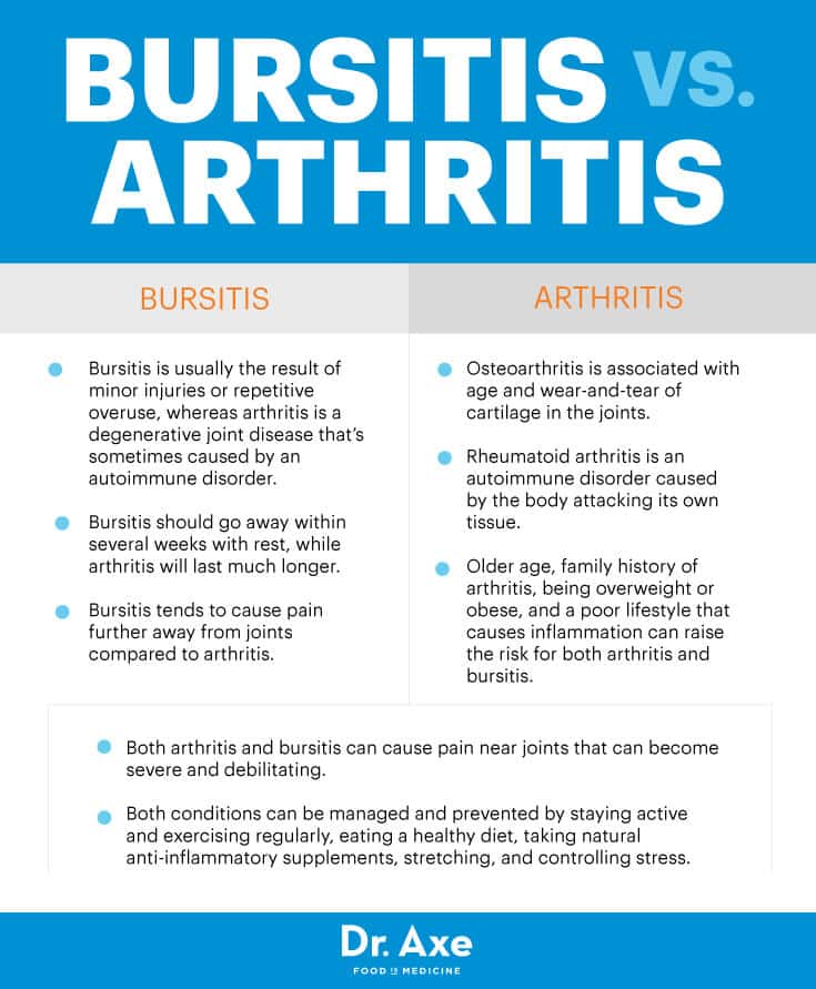 Difference between arthritis and bursitis  Lauckgoup