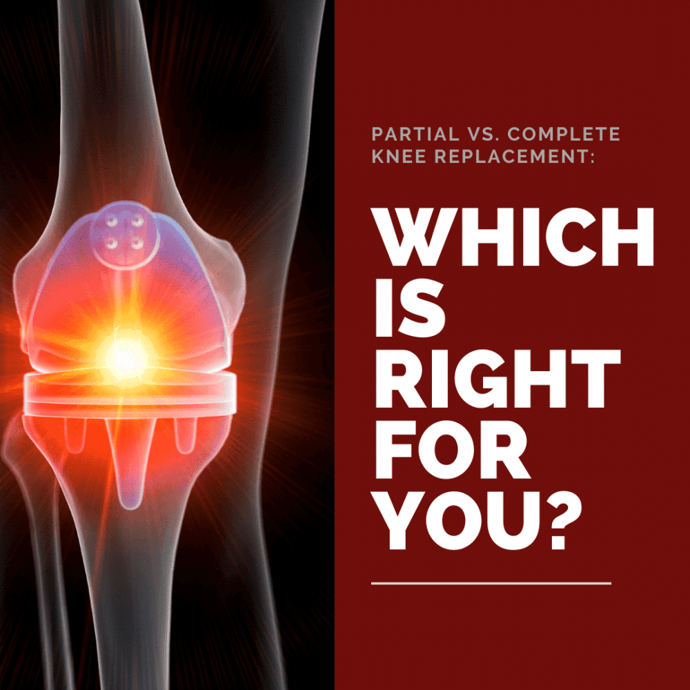 Do I Need a Partial or Total Knee Replacement?: Orthopaedic Institute ...