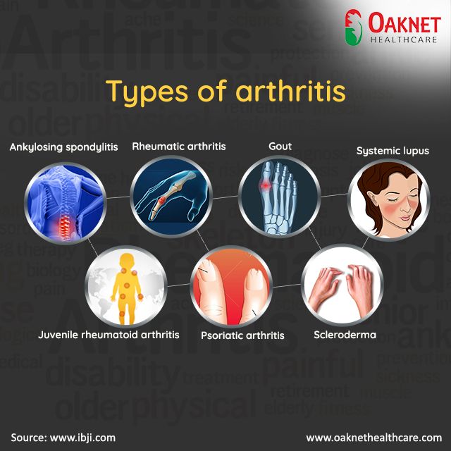 Do you know? There are nearly 100 different types of arthritis and ...