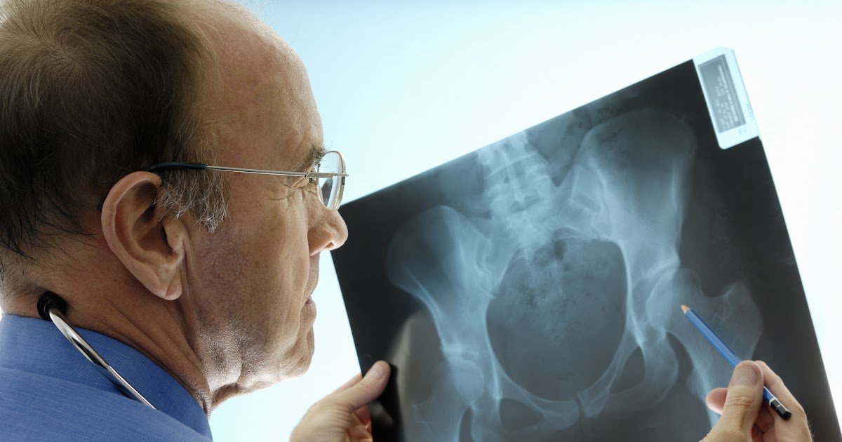 Do You See An Orthopedic Doctor For Arthritis ~ macrodesigncr