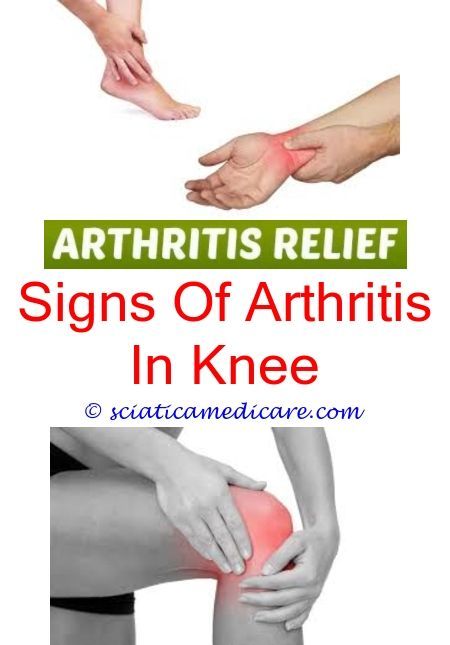 Do You Wonder What Does Arthritis Feel Like