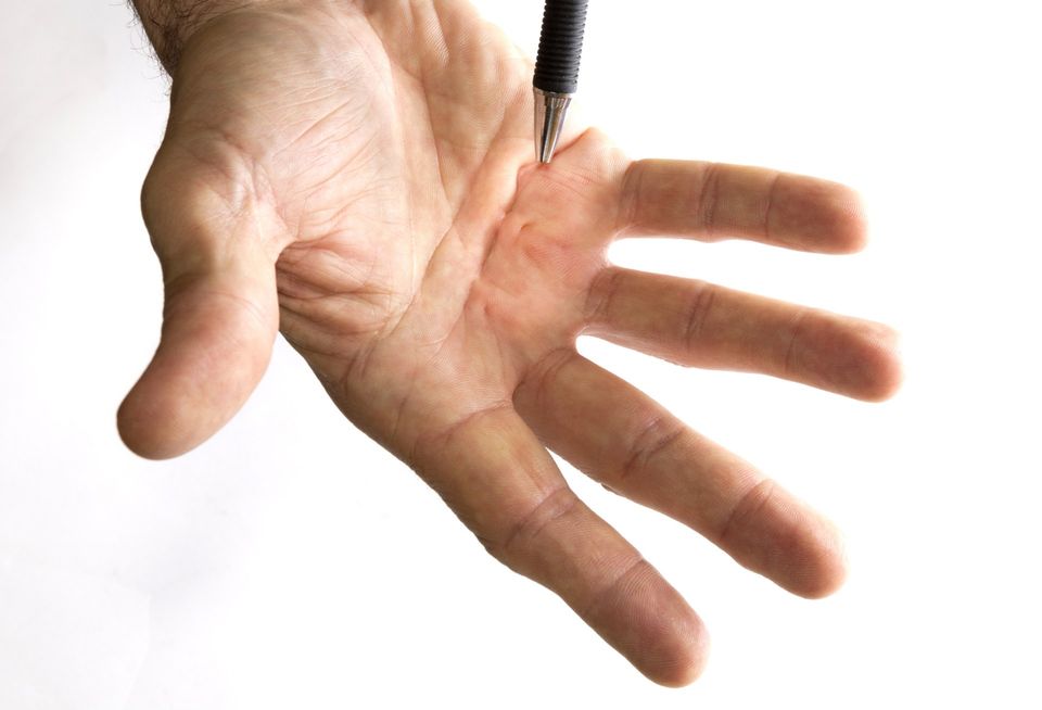 Do Your Fingers Contract Involuntarily? You Might Have ...