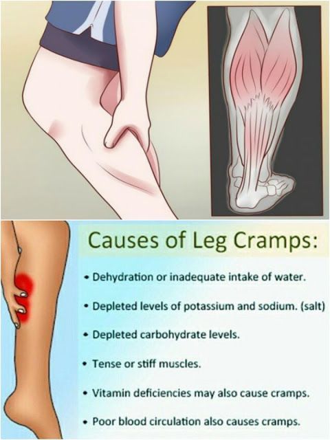 Do Your Legs Cramp At Night? Here is How to Stop it From ...