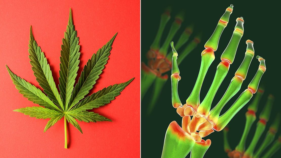 Does Cannabis Help Patients With Rheumatoid Arthritis ...