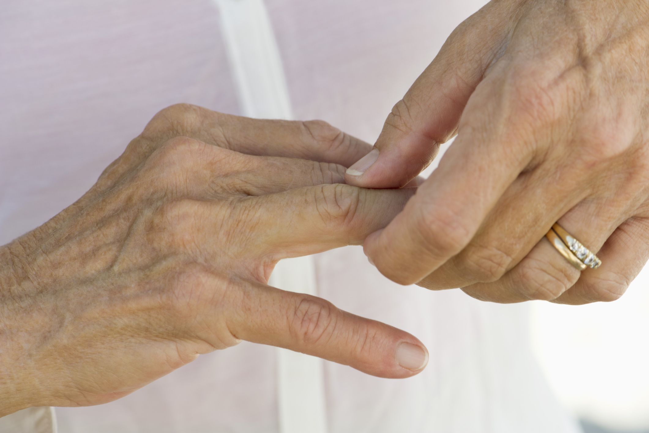 Does Joint Popping or Snapping Cause Arthritis?