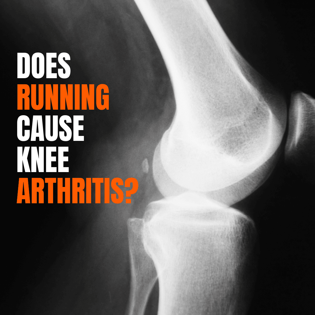 Does Running cause Knee Arthritis?