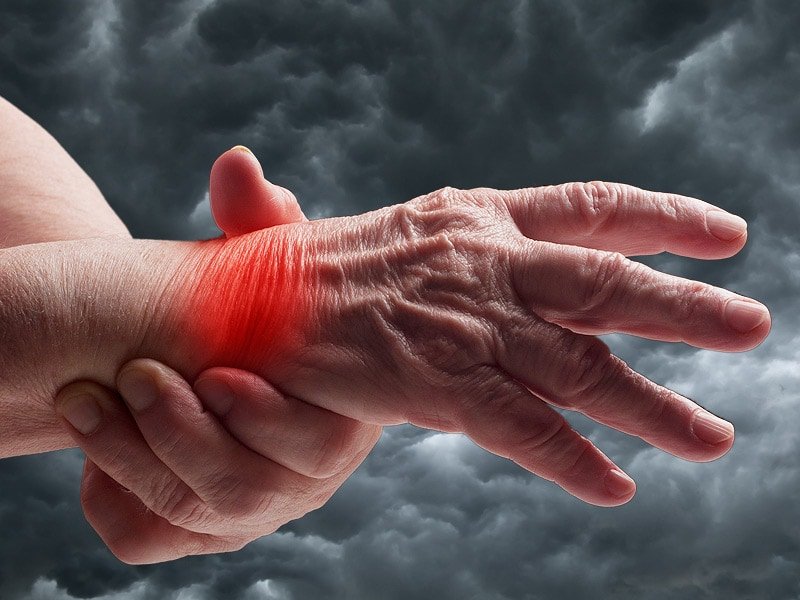 Does the Weather Affect Arthritis Symptoms?