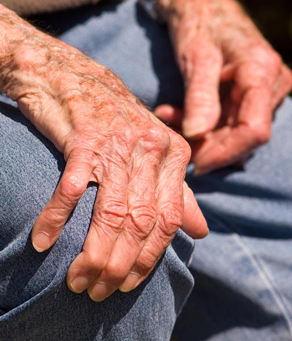Does the Weather Really Affect Arthritis Pain?