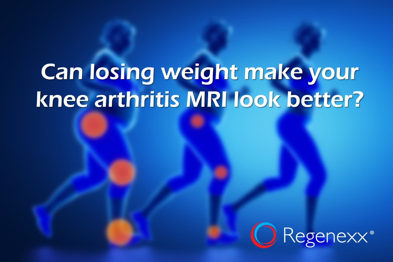 Does Weight Loss Help Knee Pain and Arthritis?