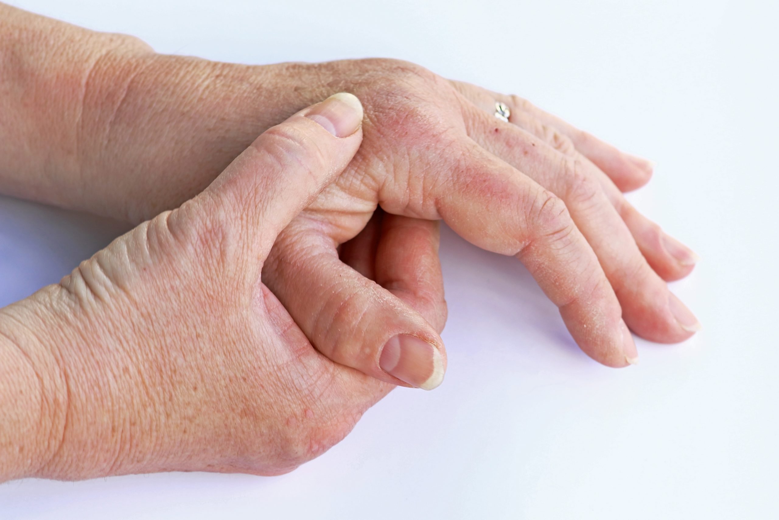 Does Your Loved One Have Elderly Onset Psoriatic Arthritis ...