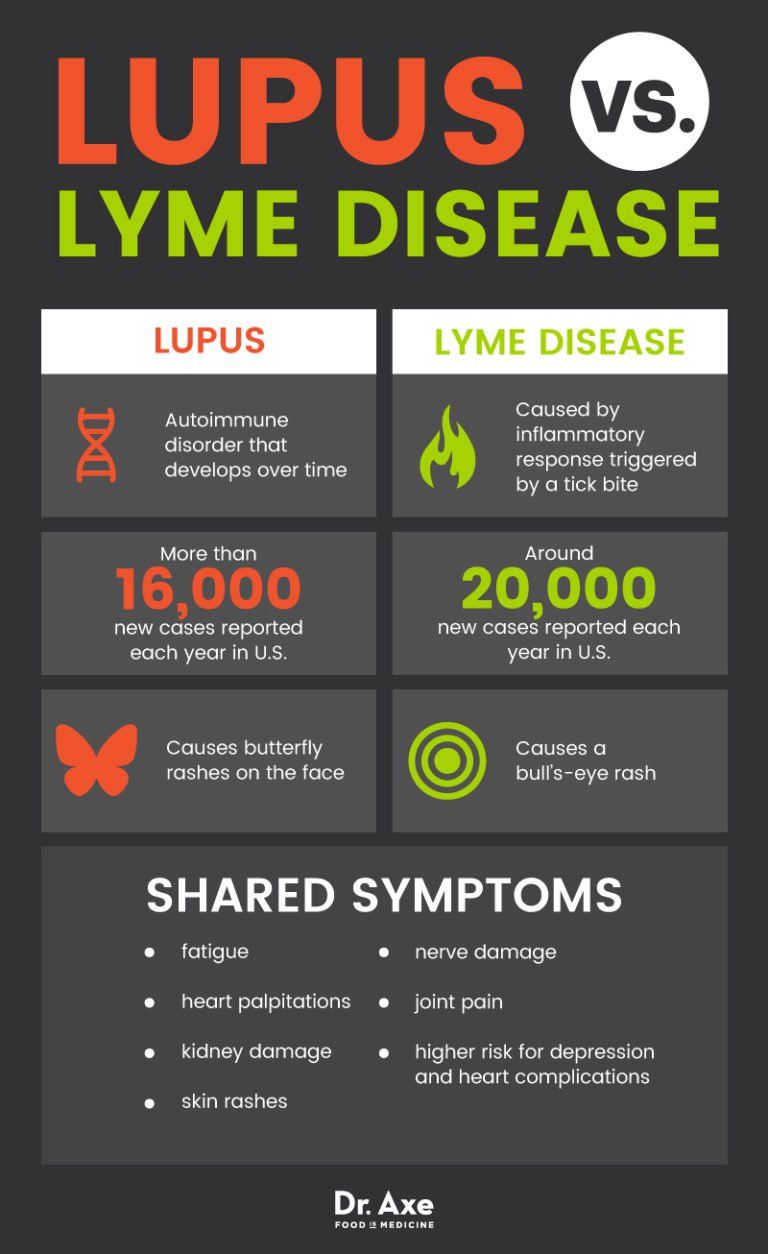Dont Ignore These Lupus Symptoms