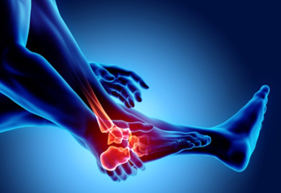 Early Signs of Arthritis in Feet