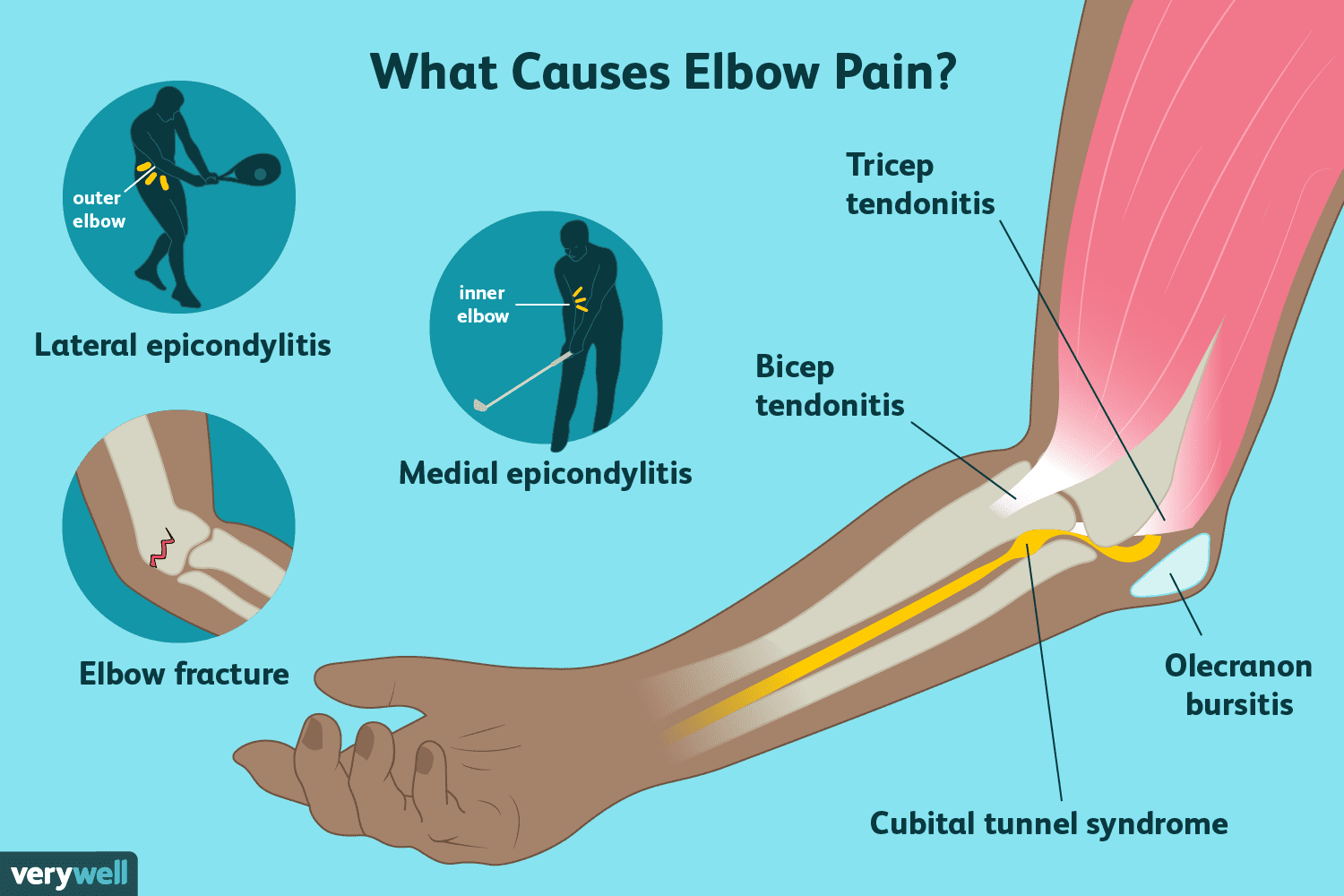 does-arthritis-cause-burning-pain-arthritisdaily