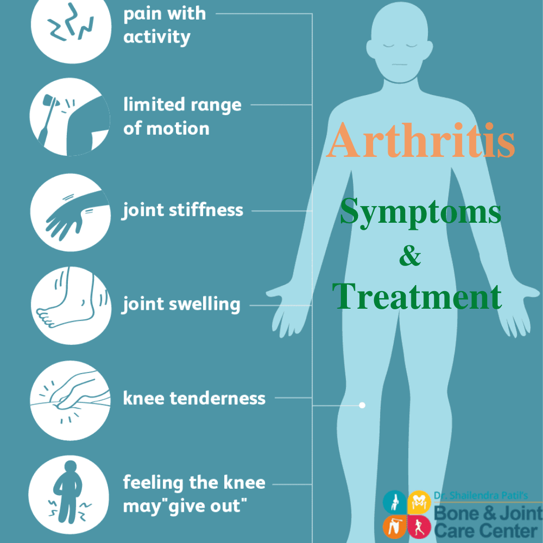 Everything You Should Know about Arthritis, Symptoms and Treatment