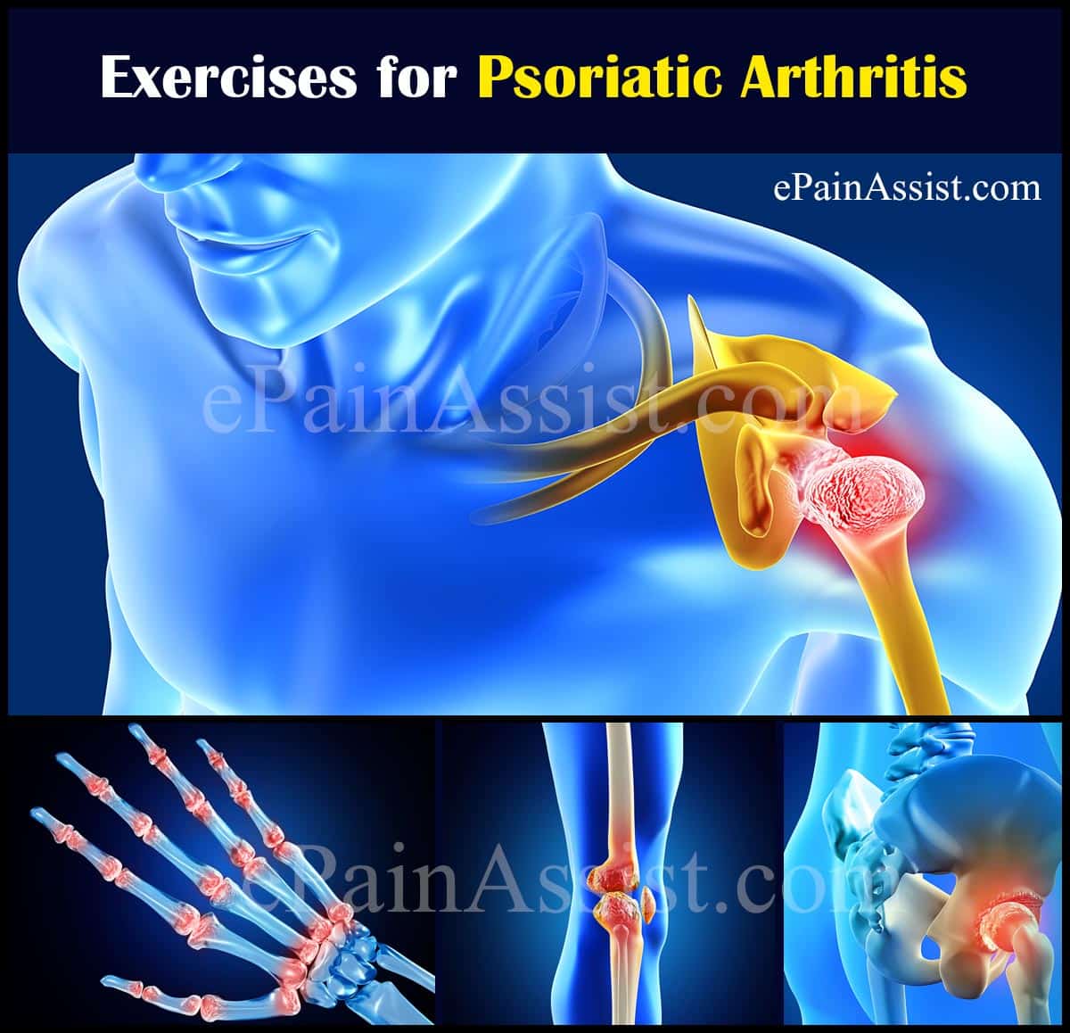 Exercises for Psoriatic Arthritis