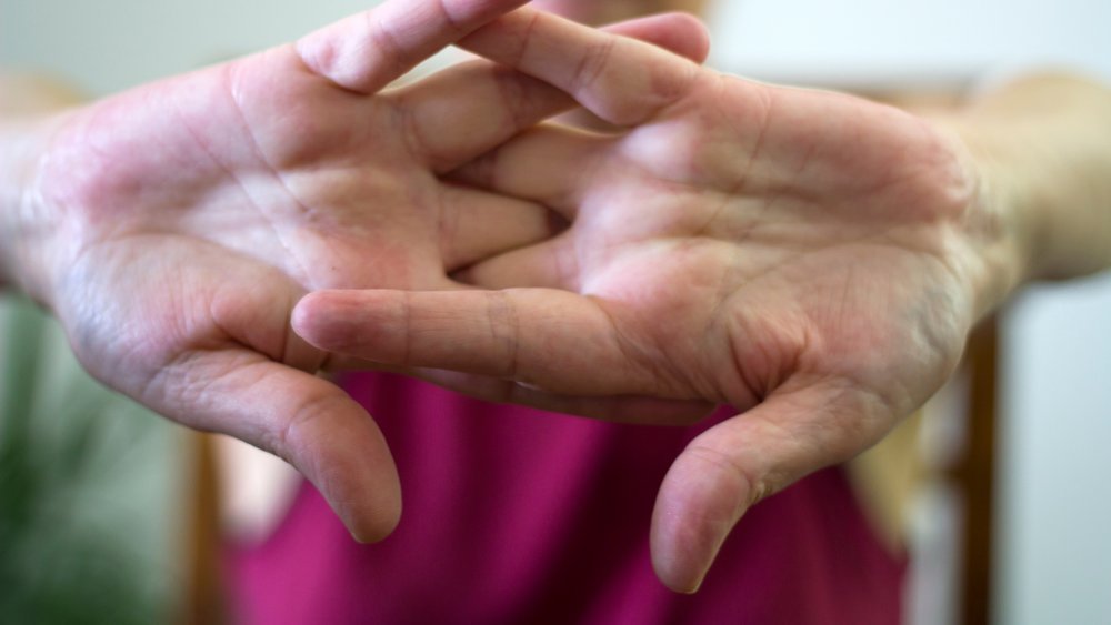 Fact or fiction: Cracking your fingers causes arthritis
