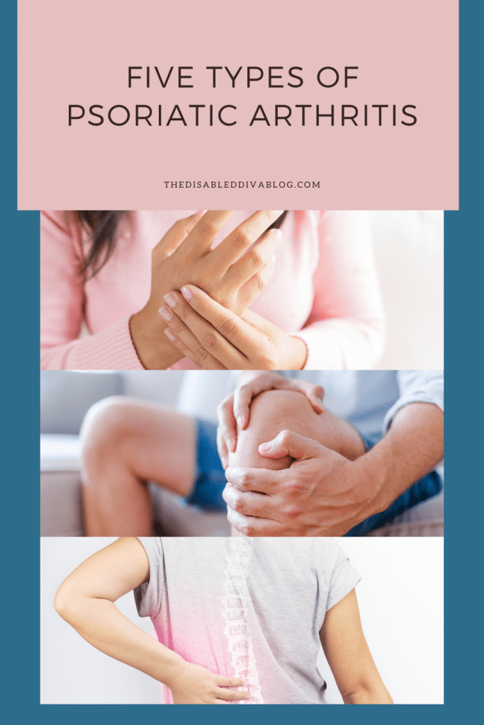 Five Types of Psoriatic Arthritis