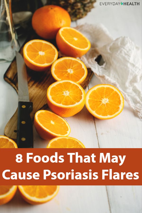 Foods in Your Diet That Cause Psoriasis Flare