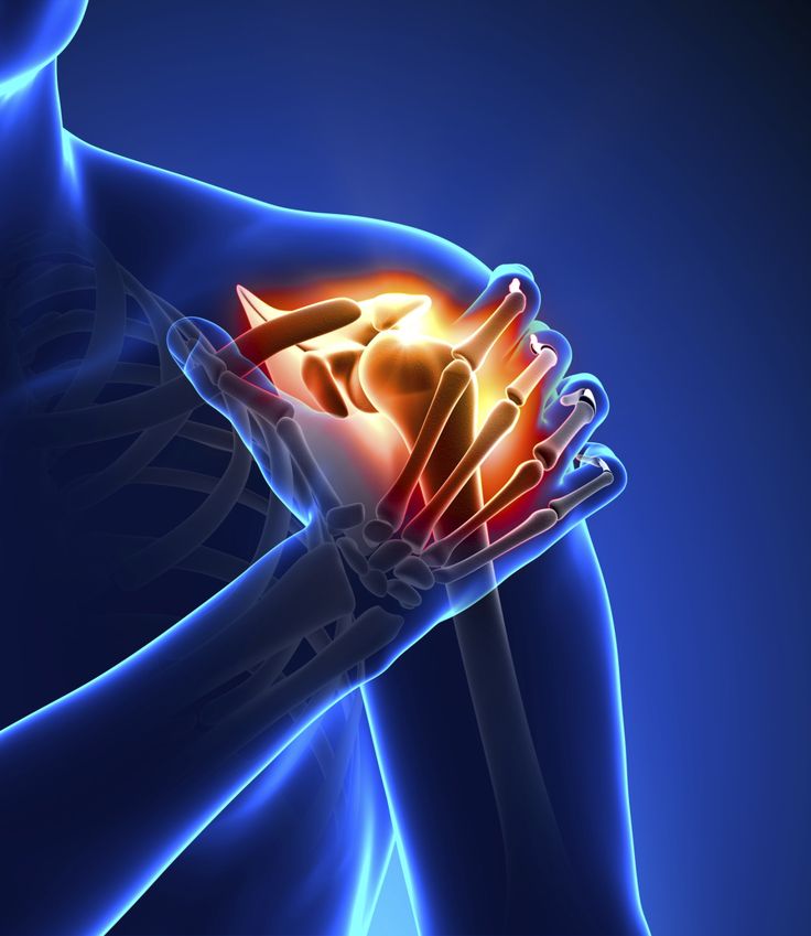Frozen Shoulder  What, Where, Why and How To Get Relief