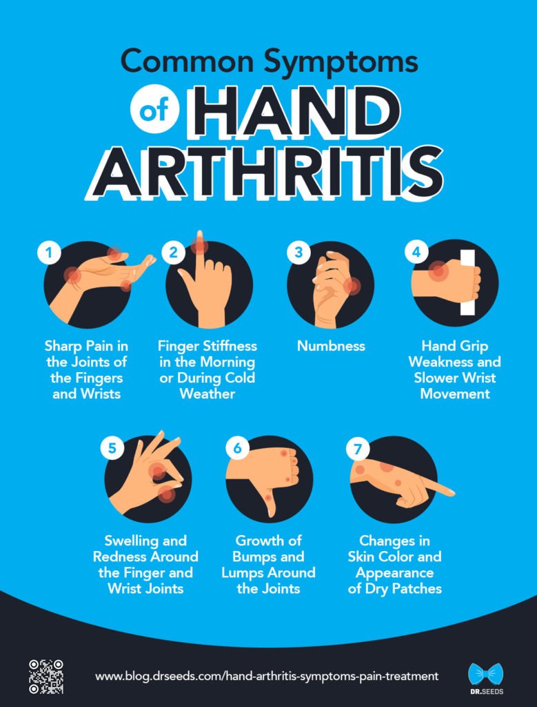 Hand Arthritis