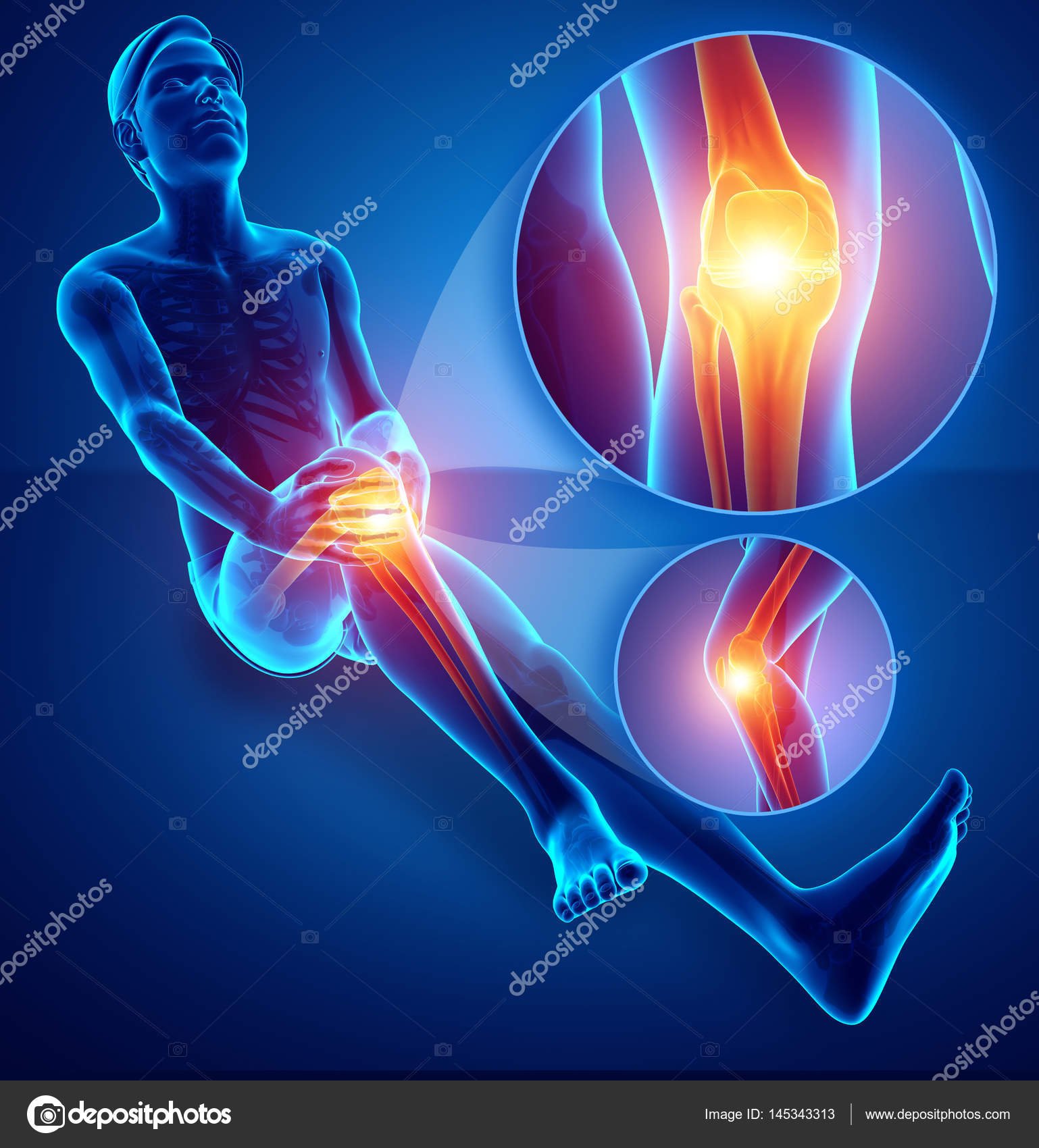 Health Scoop : JOINT PAIN AND ARTHRITIS