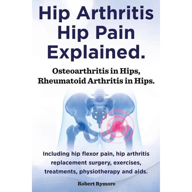 Hip Arthritis, Hip Pain Explained. Osteoarthritis in Hips, Rheumatoid ...