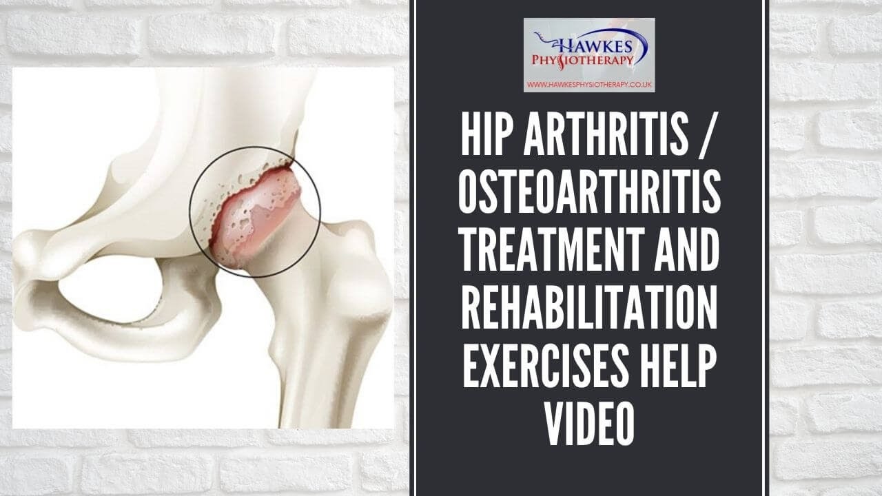 Hip arthritis / osteoarthritis treatment and rehabilitation exercises ...