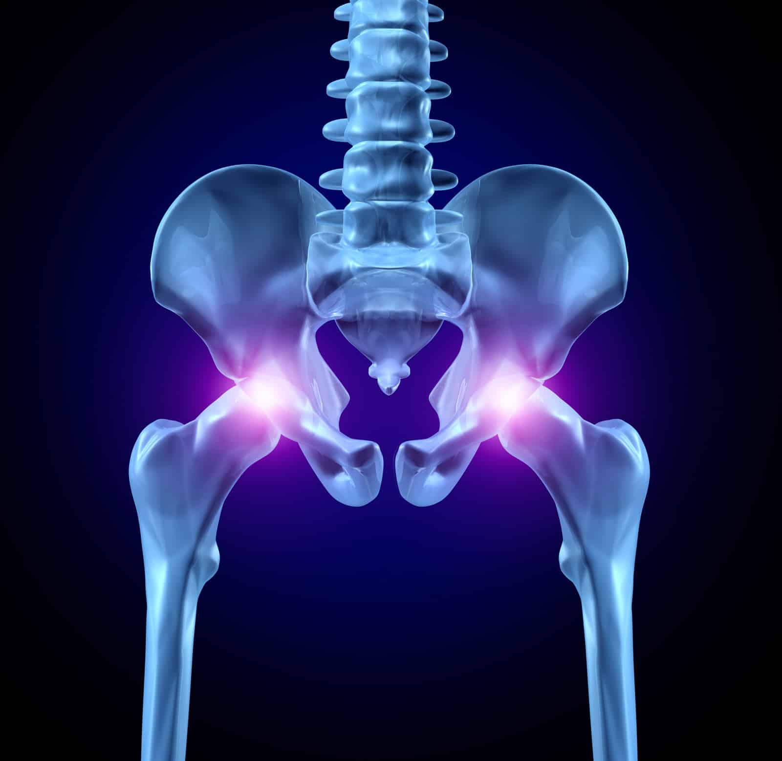 Hip injections for arthritis pain