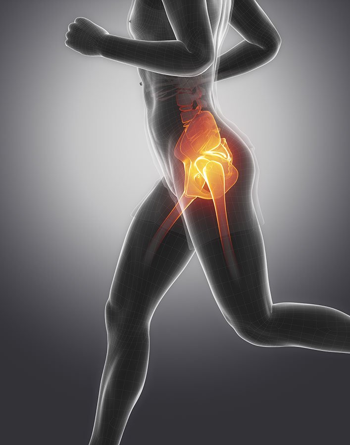 Hip Osteoarthritis: Hip joint osteoarthritis pain the hip ...
