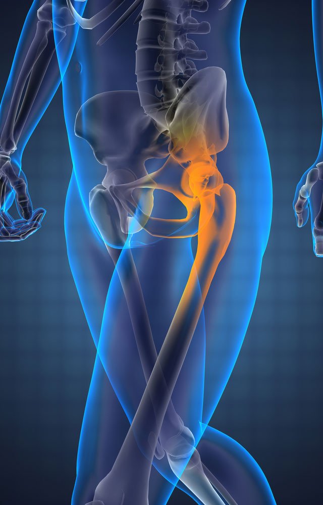 Hip Pain: What Does It Mean and How Do I Treat It?