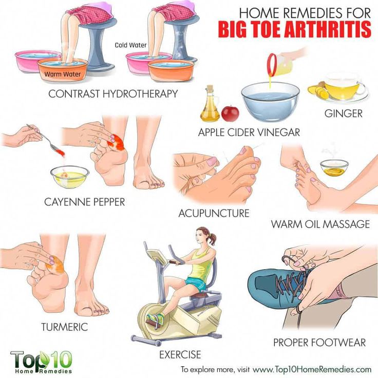 home remedies for big toe arthritis #osteoarthritis