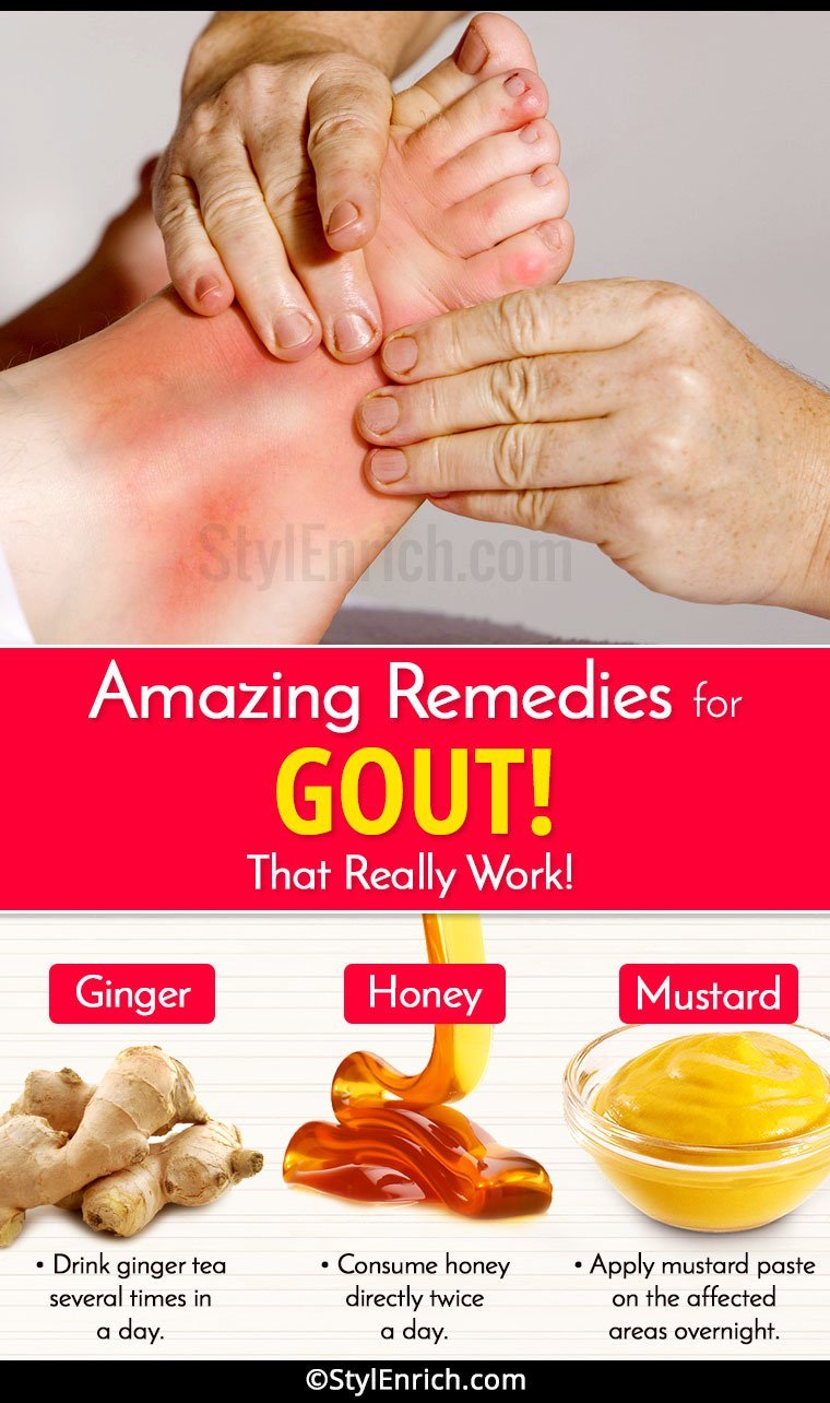 Home Remedies For Gout That Really Work and Provide Relief ...