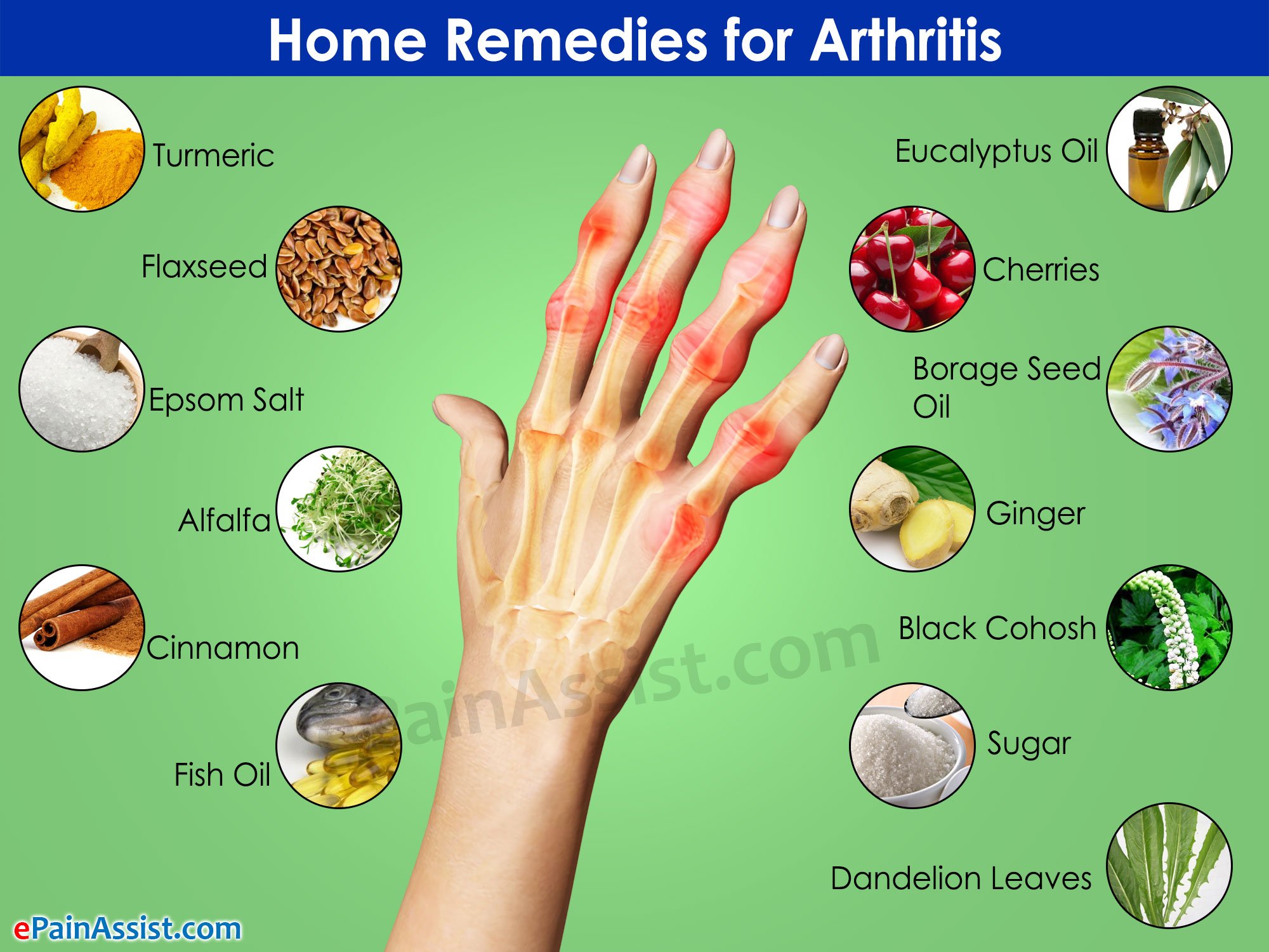 Home Remes For Swollen Ankle Due To Arthritis