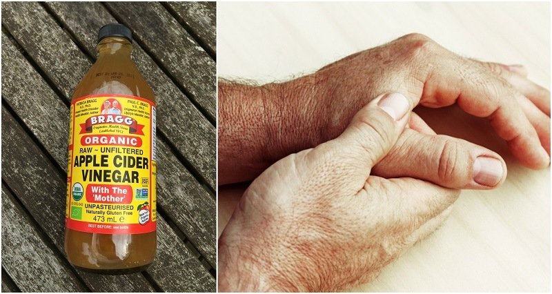 How Apple Cider Vinegar Can Help You Treat Arthritis ...