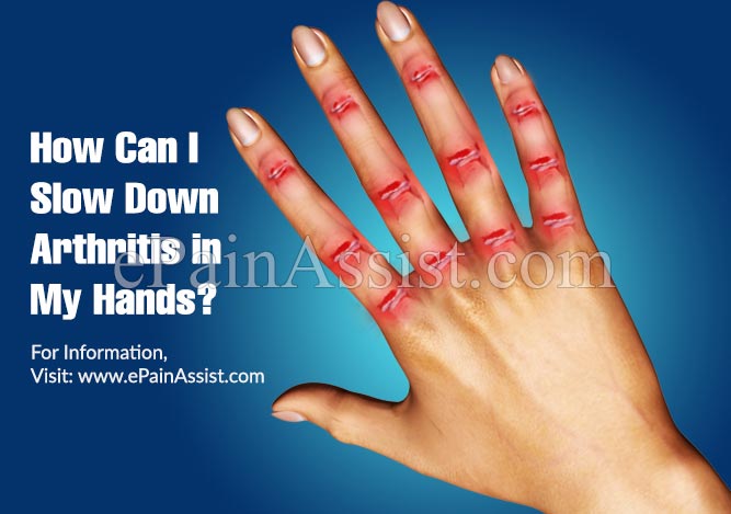 How Can I Slow Down Arthritis in My Hands?