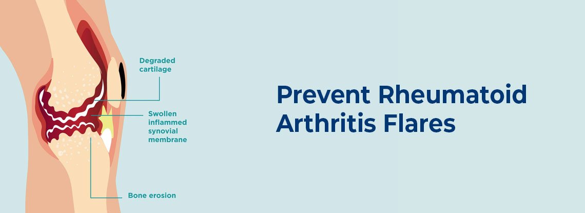 How Can You Prevent Rheumatoid Arthritis Flares : Jupiter Hospital