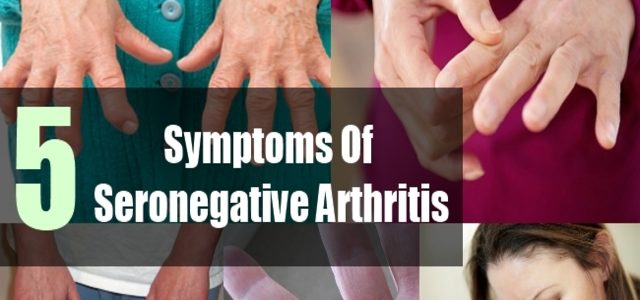How Common Is Seronegative Rheumatoid Arthritis