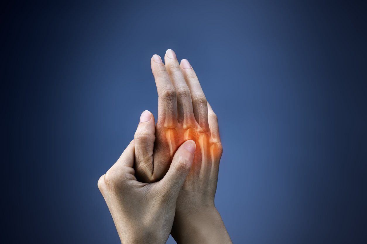 How Do I Know if I Have Rheumatoid Arthritis or Osteoarthritis in My ...