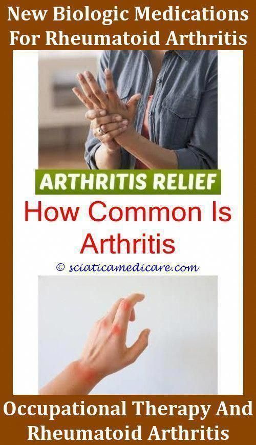 How Do You Feel When You Have Rheumatoid Arthritis,signs ...