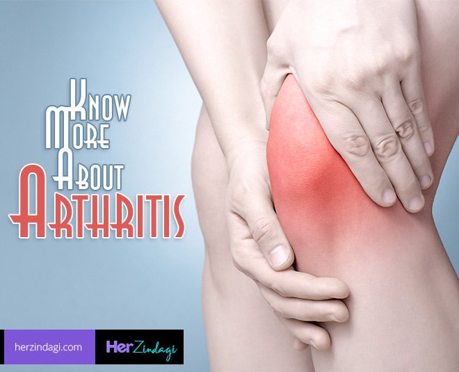 How Do You Know That You Have Arthritis?