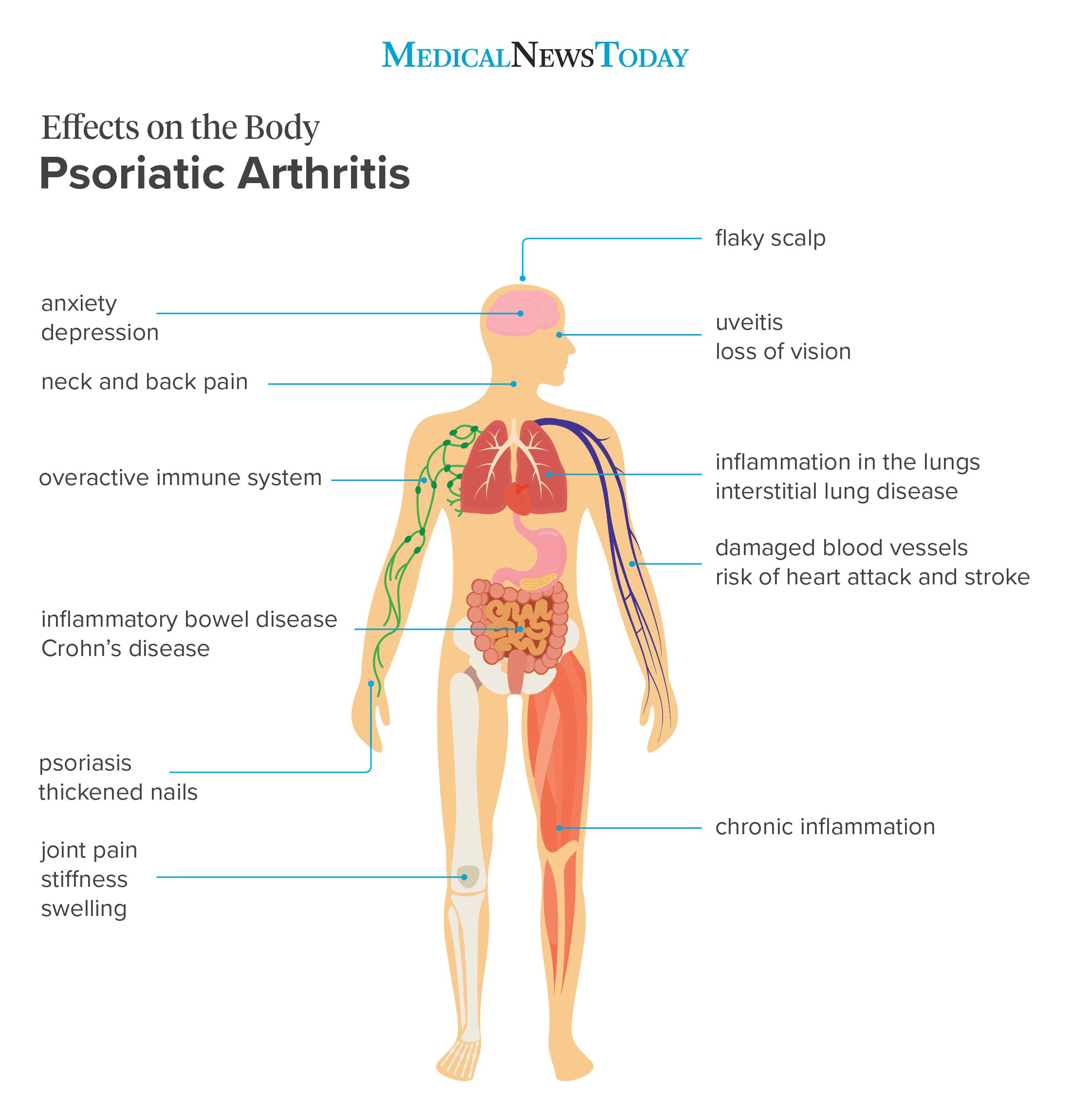 How does psoriatic arthritis affect the body?