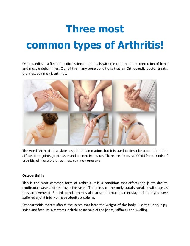 How Many Kinds Of Arthritis Are There