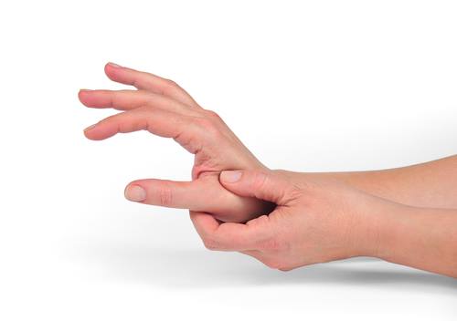 How to Deal with Rheumatoid Arthritis (RA)