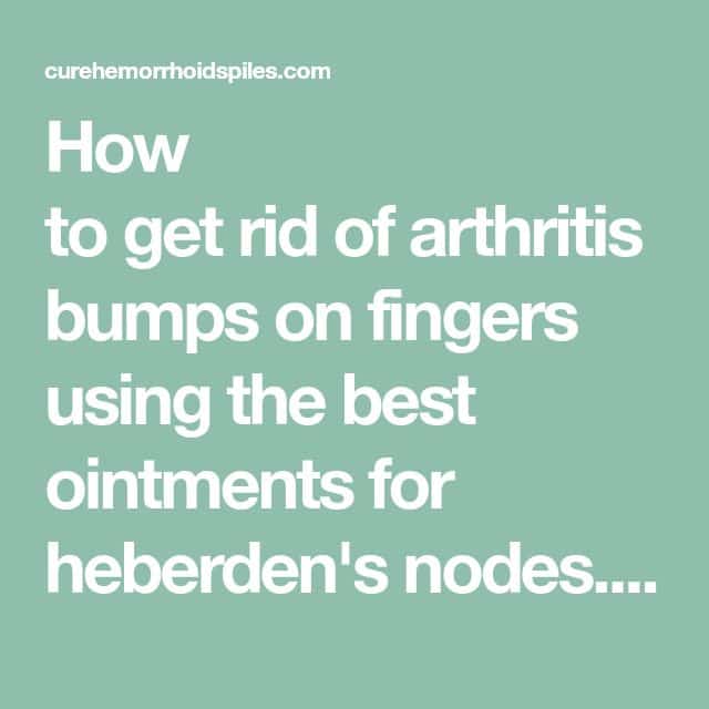 How to get rid of arthritis bumps on fingers using the best ointments ...